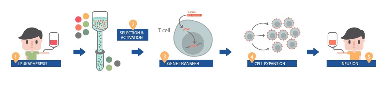 For the treatment, patient’s white blood cells are harvested by leukaphoresis (1), separated or enriched for appropriate T cells (2), CAR gene sequences is inserted into the T cell’s DNA (3) and the modified T cells are expanded ex-vivo (4). Subsequently, T cells are infused back into the patients (5), where modified T cells can multiply when they encounter the targeted proteins and kill the targeted cancer cell. 